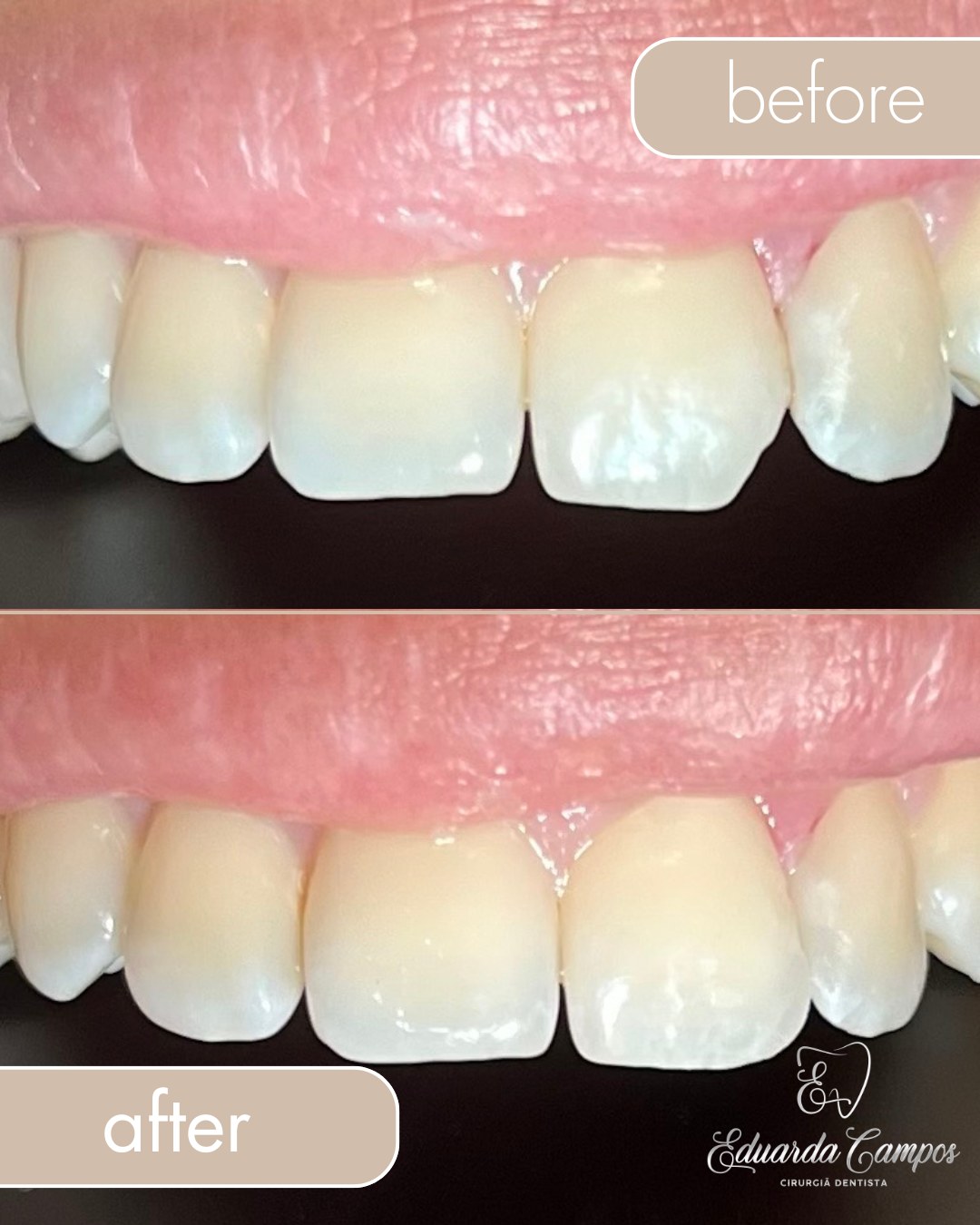 Resultado antes e depois de tratamento odontológico